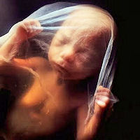 http://www.catholicculture.org/culture/liturgicalyear/pictures/10_22_unborn.jpg